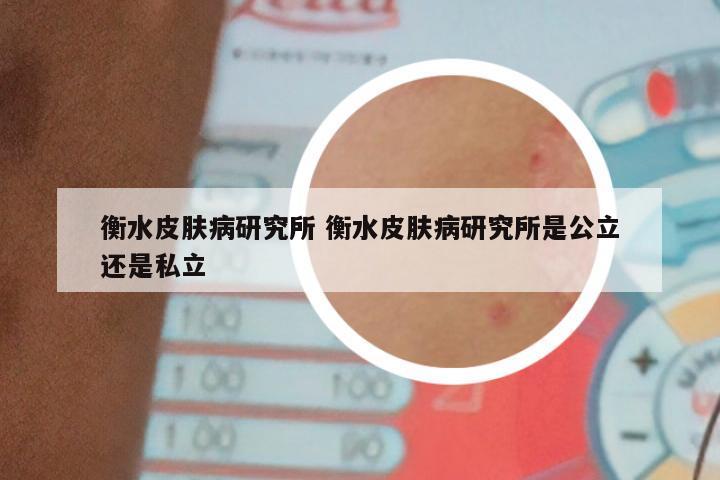 衡水皮肤病研究所 衡水皮肤病研究所是公立还是私立