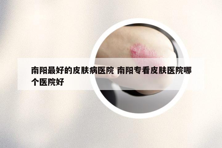 南阳最好的皮肤病医院 南阳专看皮肤医院哪个医院好