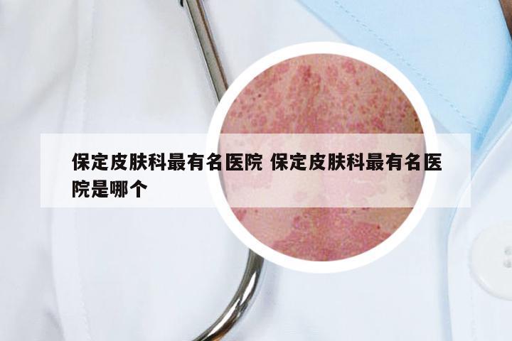 保定皮肤科最有名医院 保定皮肤科最有名医院是哪个
