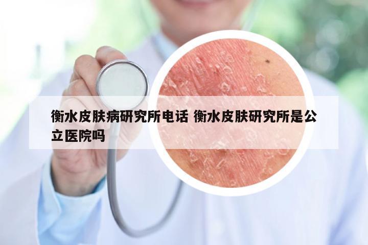 衡水皮肤病研究所电话 衡水皮肤研究所是公立医院吗