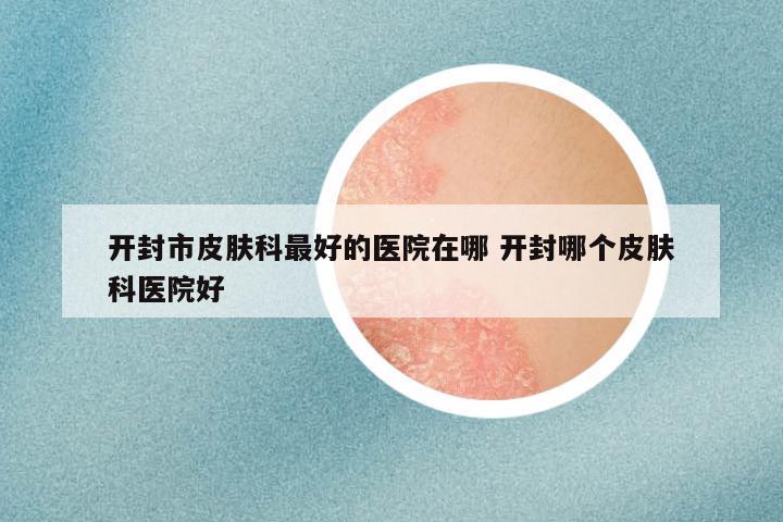 开封市皮肤科最好的医院在哪 开封哪个皮肤科医院好
