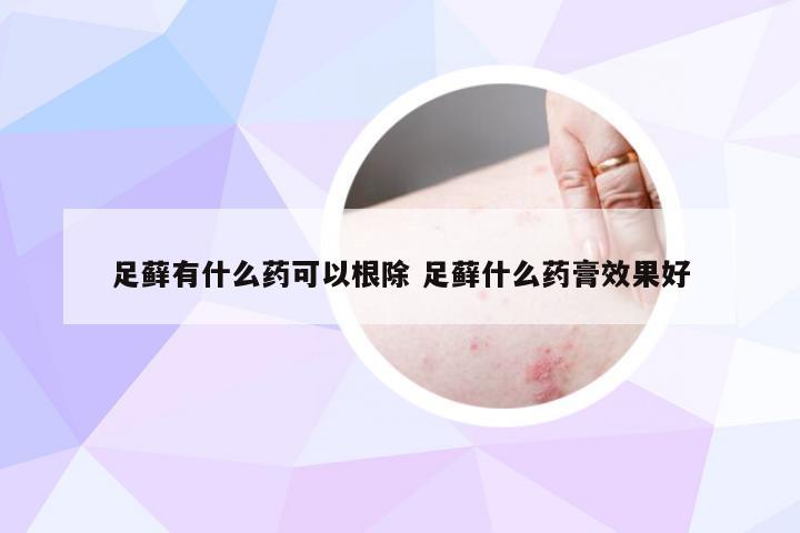 足藓有什么药可以根除 足藓什么药膏效果好