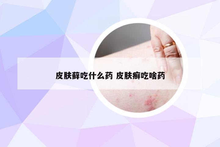 皮肤藓吃什么药 皮肤癣吃啥药
