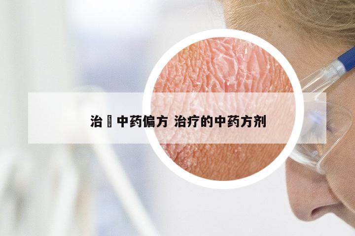 治廯中药偏方 治疗的中药方剂
