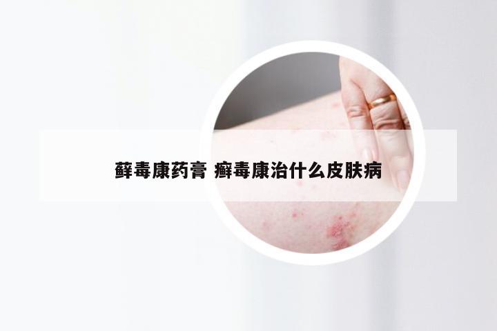 藓毒康药膏 癣毒康治什么皮肤病