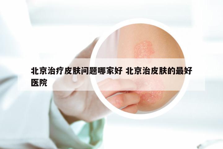 北京治疗皮肤问题哪家好 北京治皮肤的最好医院