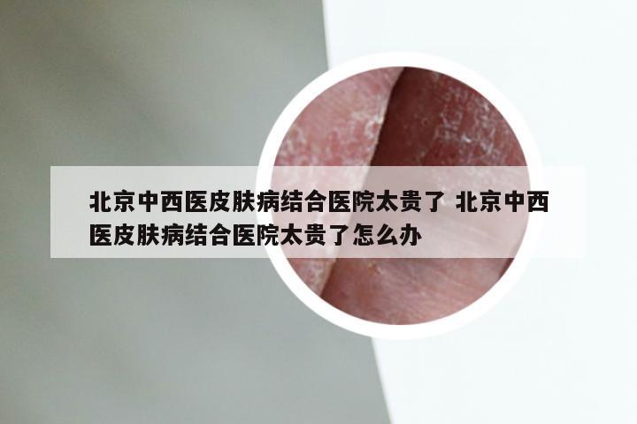 北京中西医皮肤病结合医院太贵了 北京中西医皮肤病结合医院太贵了怎么办