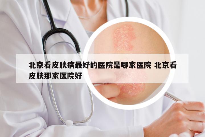 北京看皮肤病最好的医院是哪家医院 北京看皮肤那家医院好