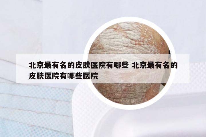 北京最有名的皮肤医院有哪些 北京最有名的皮肤医院有哪些医院