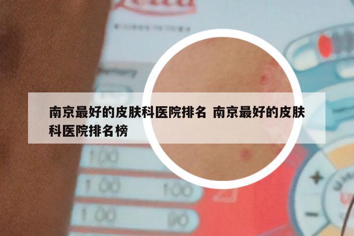 南京最好的皮肤科医院排名 南京最好的皮肤科医院排名榜