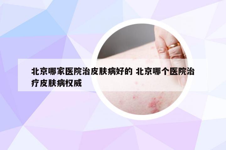 北京哪家医院治皮肤病好的 北京哪个医院治疗皮肤病权威