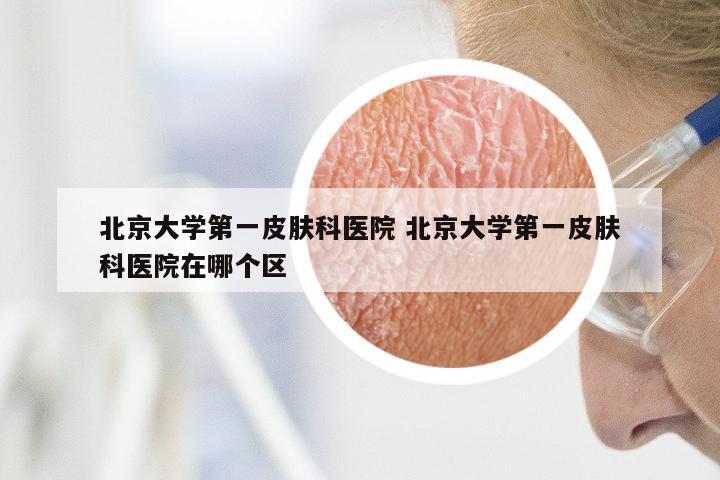北京大学第一皮肤科医院 北京大学第一皮肤科医院在哪个区