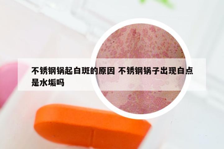 不锈钢锅起白斑的原因 不锈钢锅子出现白点是水垢吗