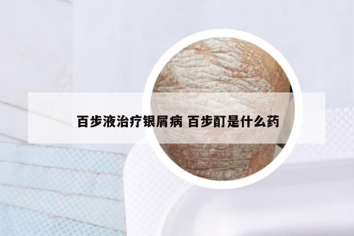 百步液治疗银屑病 百步酊是什么药