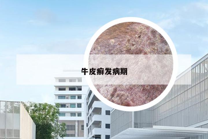 牛皮癣发病期