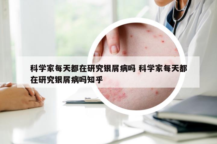 科学家每天都在研究银屑病吗 科学家每天都在研究银屑病吗知乎