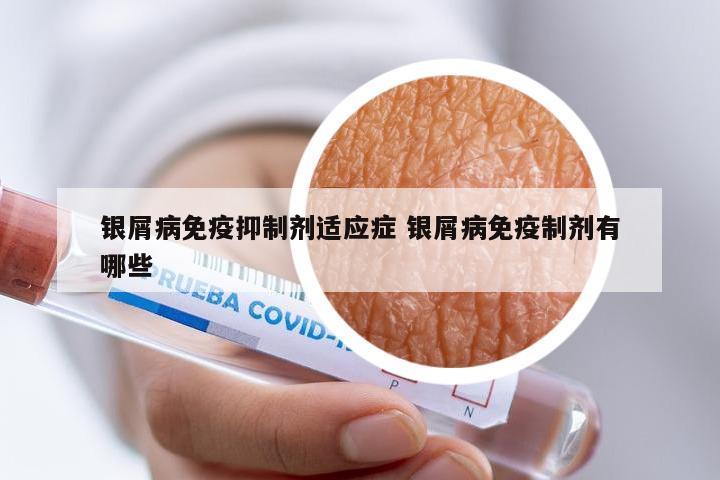 银屑病免疫抑制剂适应症 银屑病免疫制剂有哪些
