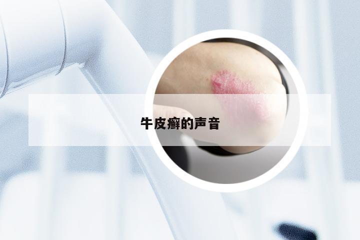 牛皮癣的声音