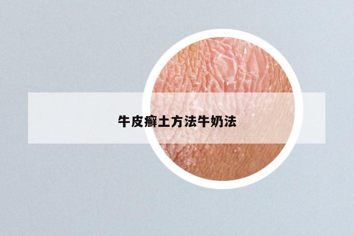 牛皮癣土方法牛奶法
