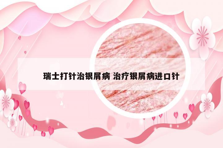 瑞士打针治银屑病 治疗银屑病进口针