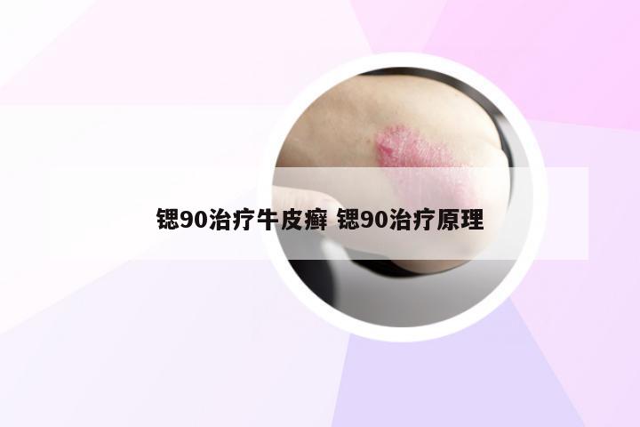 锶90治疗牛皮癣 锶90治疗原理