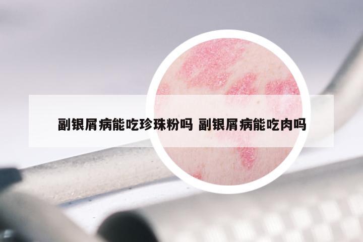 副银屑病能吃珍珠粉吗 副银屑病能吃肉吗