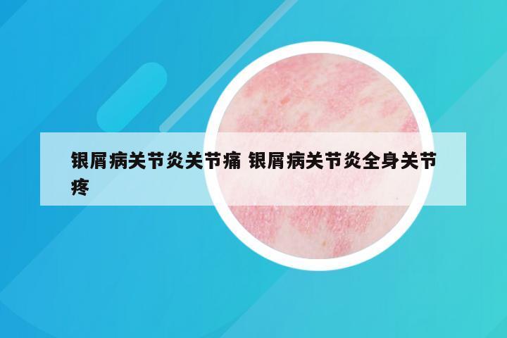 银屑病关节炎关节痛 银屑病关节炎全身关节疼
