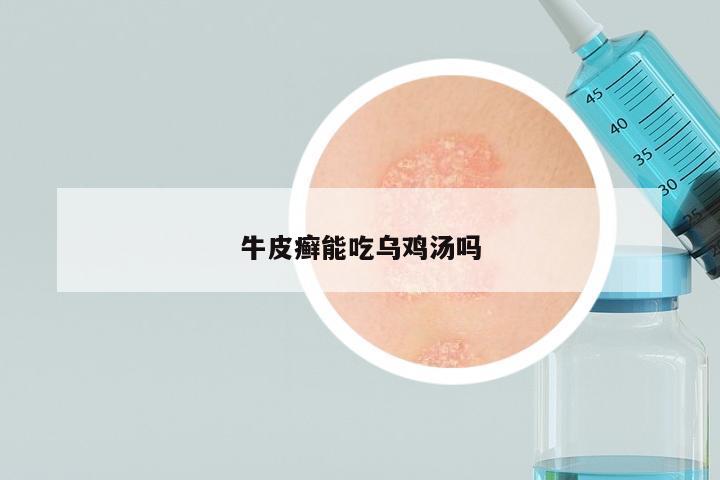 牛皮癣能吃乌鸡汤吗