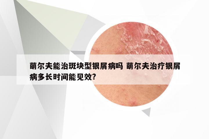 萌尔夫能治斑块型银屑病吗 萌尔夫治疗银屑病多长时间能见效?