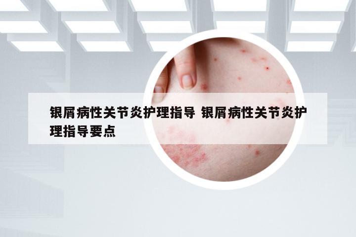 银屑病性关节炎护理指导 银屑病性关节炎护理指导要点