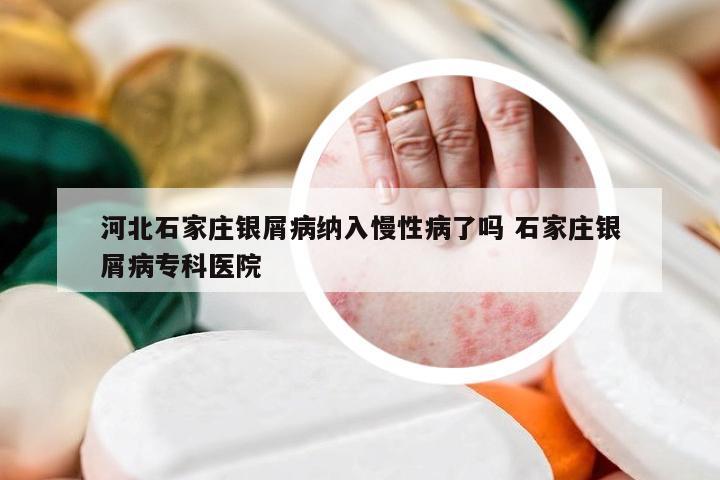 河北石家庄银屑病纳入慢性病了吗 石家庄银屑病专科医院