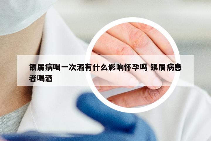 银屑病喝一次酒有什么影响怀孕吗 银屑病患者喝酒