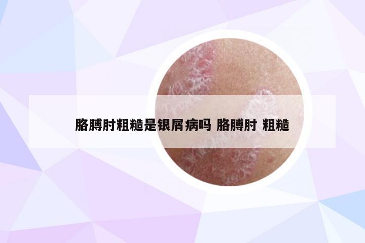 胳膊肘粗糙是银屑病吗 胳膊肘 粗糙