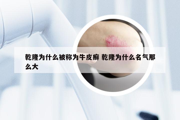 乾隆为什么被称为牛皮癣 乾隆为什么名气那么大