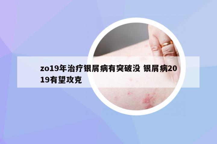 zo19年治疗银屑病有突破没 银屑病2019有望攻克