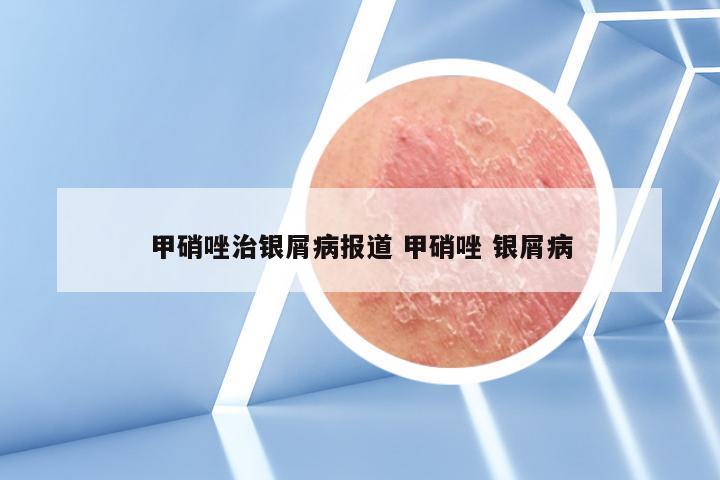 甲硝唑治银屑病报道 甲硝唑 银屑病