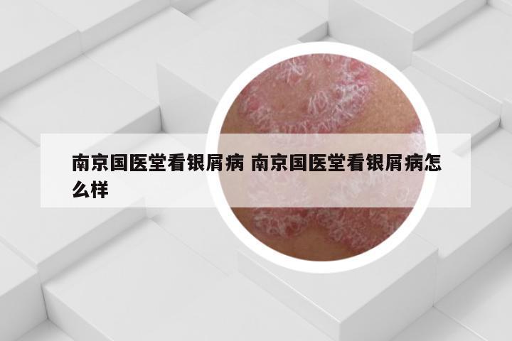 南京国医堂看银屑病 南京国医堂看银屑病怎么样