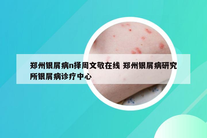 郑州银屑病n择周文敬在线 郑州银屑病研究所银屑病诊疗中心