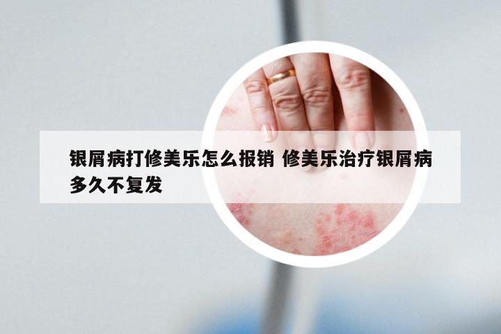 银屑病打修美乐怎么报销 修美乐治疗银屑病多久不复发