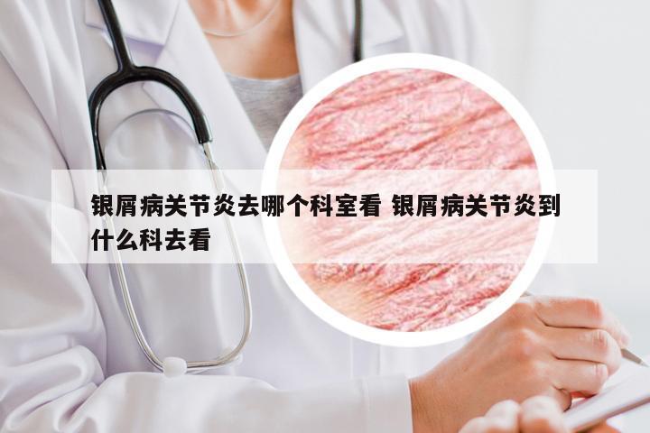 银屑病关节炎去哪个科室看 银屑病关节炎到什么科去看