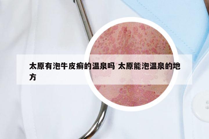 太原有泡牛皮癣的温泉吗 太原能泡温泉的地方