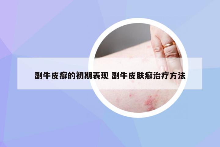 副牛皮癣的初期表现 副牛皮肤癣治疗方法