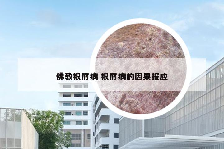 佛教银屑病 银屑病的因果报应