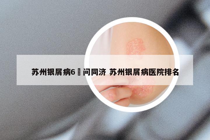 苏州银屑病6來问同济 苏州银屑病医院排名