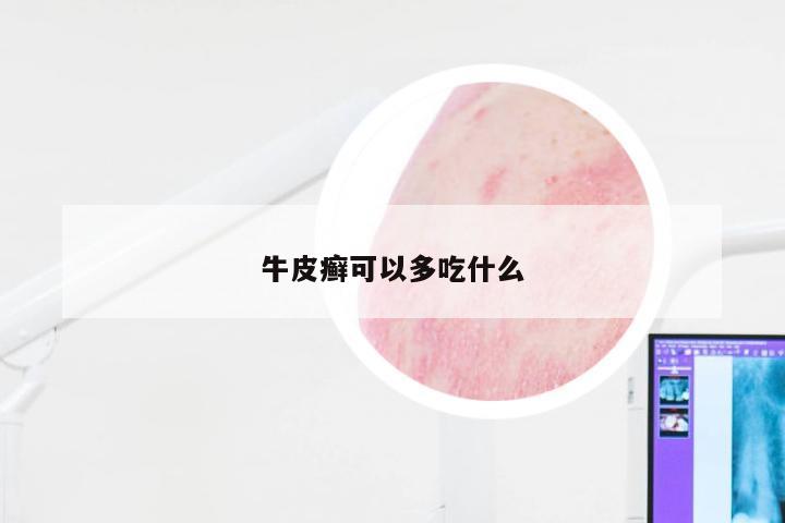 牛皮癣可以多吃什么