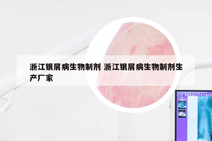 浙江银屑病生物制剂 浙江银屑病生物制剂生产厂家