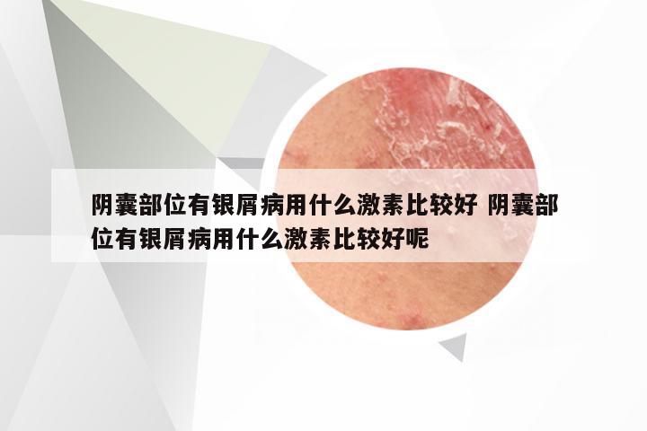 阴囊部位有银屑病用什么激素比较好 阴囊部位有银屑病用什么激素比较好呢