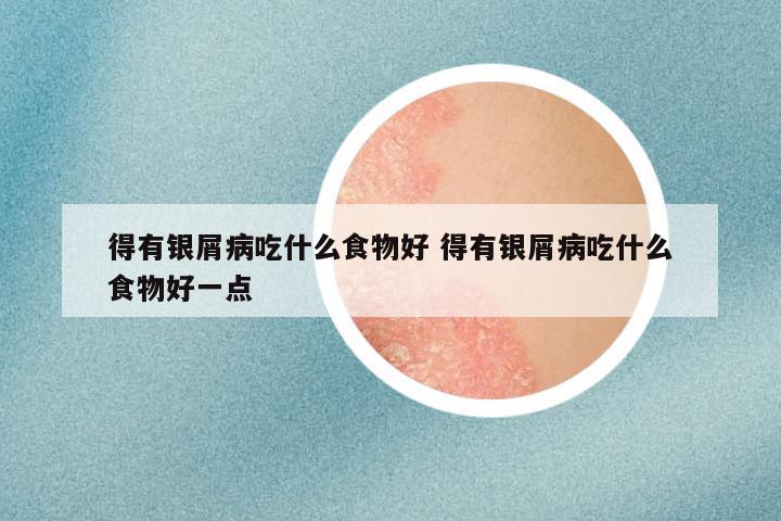 得有银屑病吃什么食物好 得有银屑病吃什么食物好一点