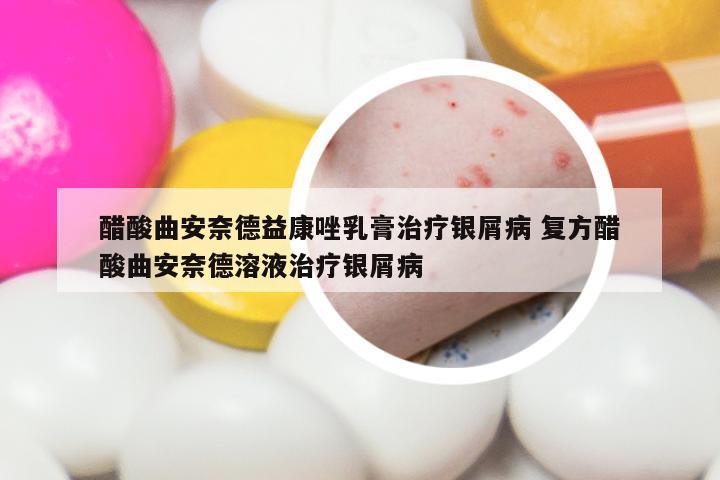 醋酸曲安奈德益康唑乳膏治疗银屑病 复方醋酸曲安奈德溶液治疗银屑病