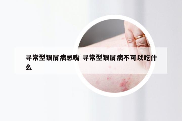 寻常型银屑病忌嘴 寻常型银屑病不可以吃什么